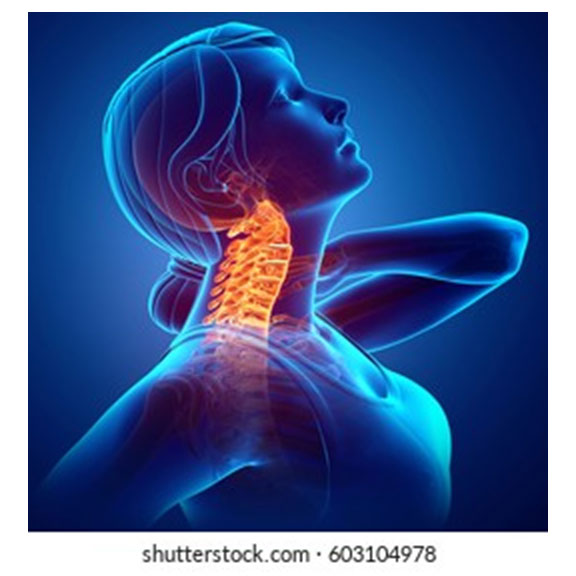 Stylized woman with neck pain