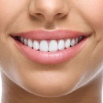 close up of woman's smile with white teeth