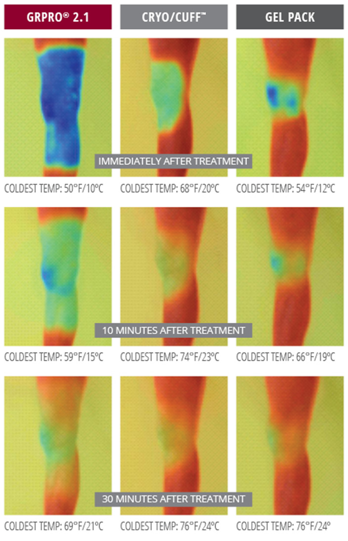 Game Ready Thermal Images