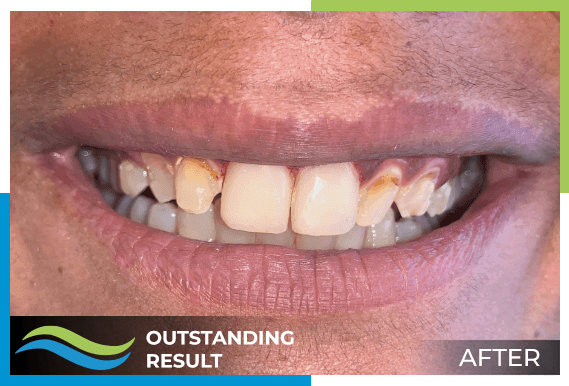 outstanding results after 