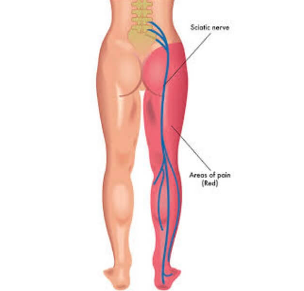 leg illustration