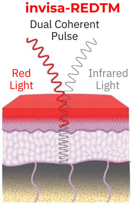 InvisaRed Diagram