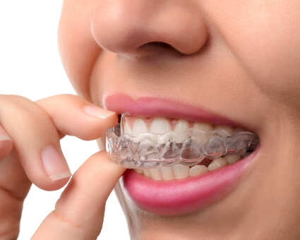 Female Invisalign patient