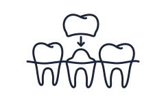 Illustration of dental crown