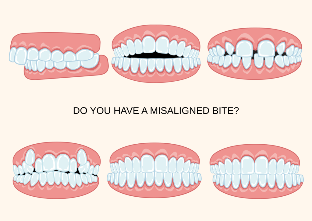 tired of hiding your smile (1)