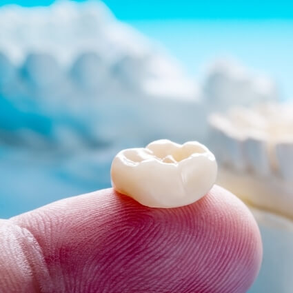 Dentist holding dental crown on finger