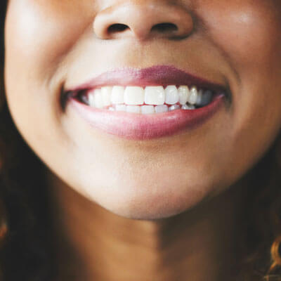 closeup of pretty white smile