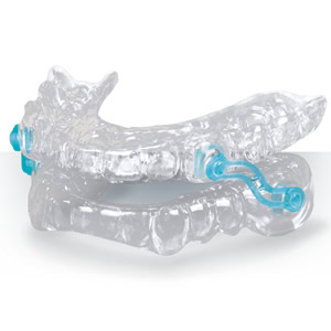 Mandibular Advancement Splint device