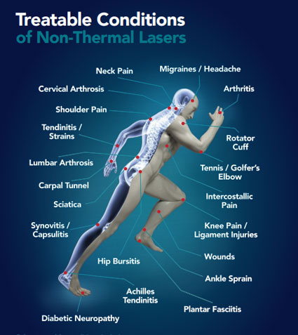 cold-laser-therapy-conditions