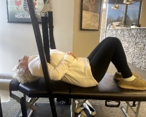 Hunchback Spinal Remodeling