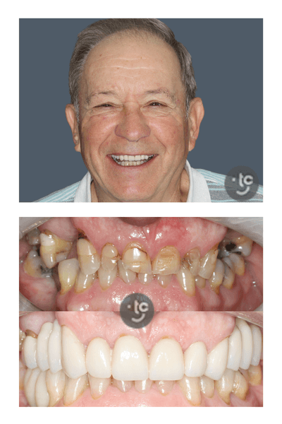 Andrew before and after