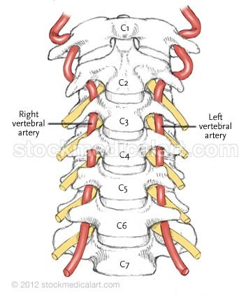 Illustration: Vertebral artery
