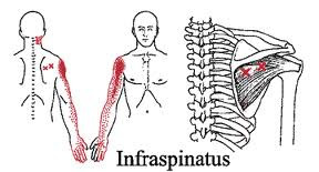 infraspinatus