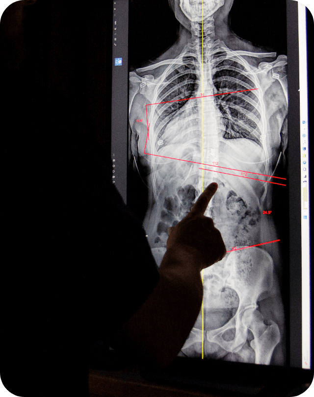 Xray results