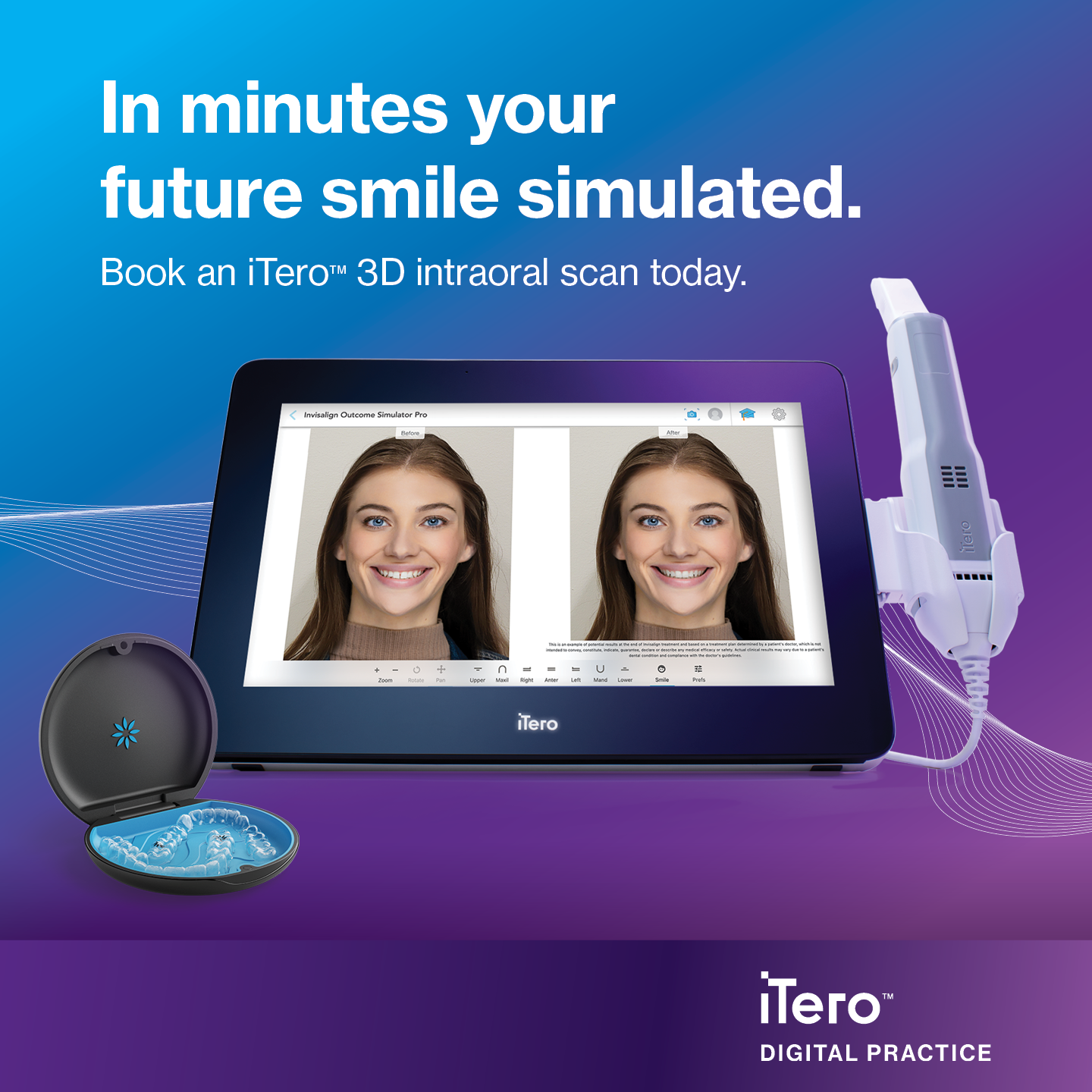 smile simulation 3D scan technology