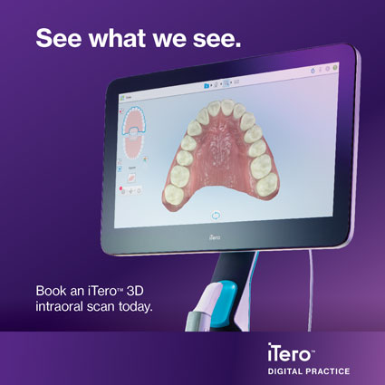 iTero intraoral scan