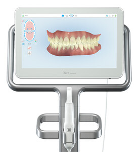 itero digital scanner