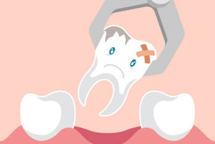 illustration of tooth being extracted