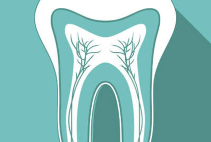 illustration of root canal