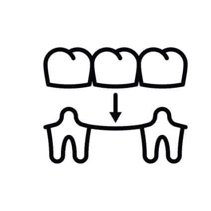 basic-black-and-white-bridge-illustration-sq