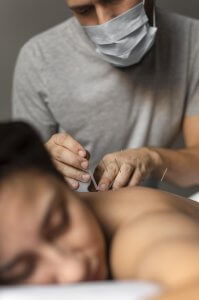 close-up-therapist-doing-acupuncture