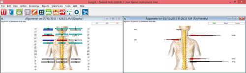 algometer scans