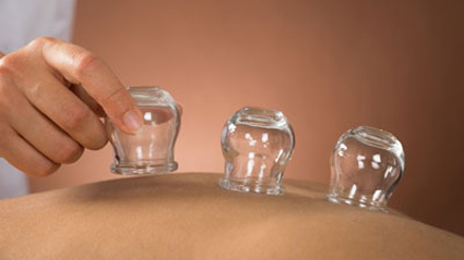Patient with cupping applied