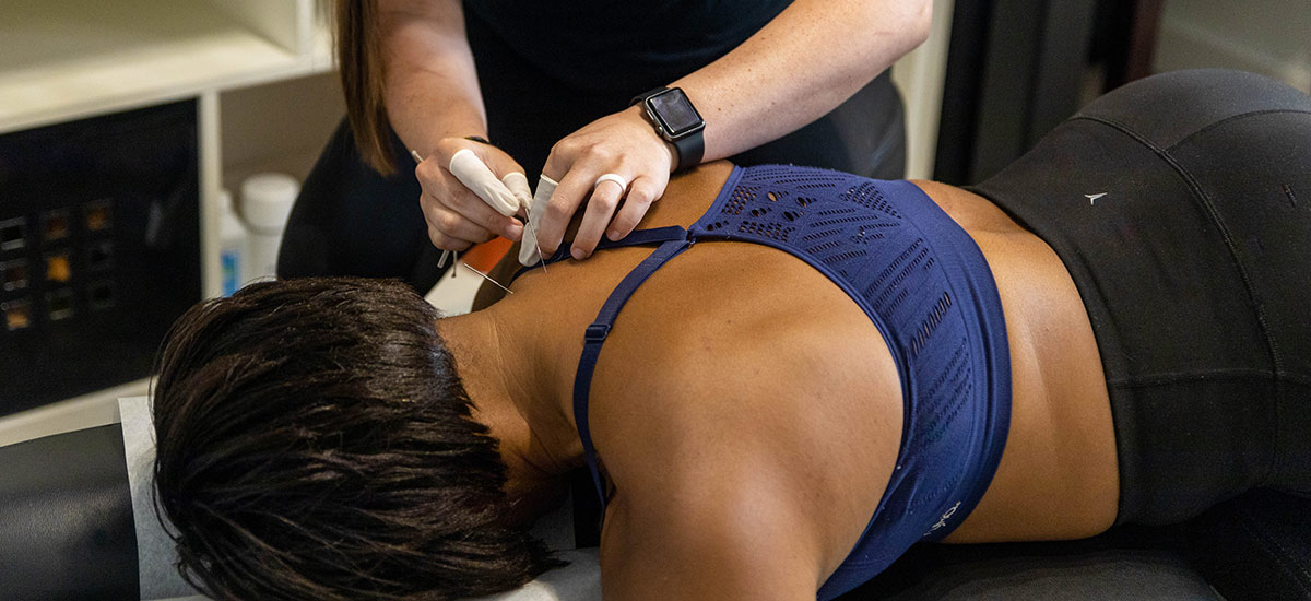person during dry needling treatment