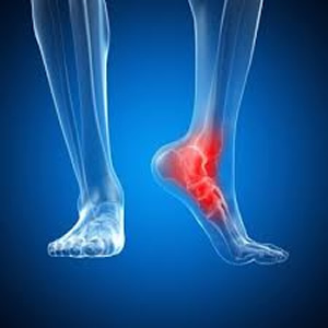 My ankles feel stiff and my feet hurt! Can Chiropractic help that ...