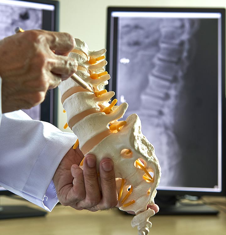 Doctor pointing at spine model
