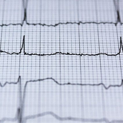 printout of a heart rate graph