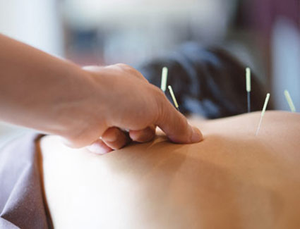 Dry needles in persons back