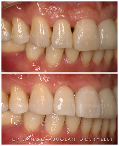 Bioclear Before and After-1