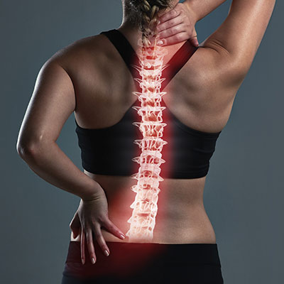 illustration of a spine on a woman's back