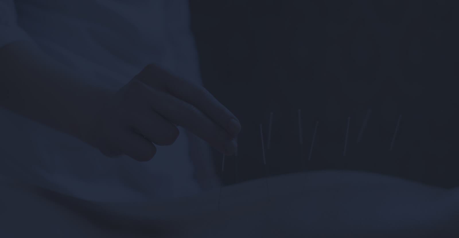 ACUPUNCTURE