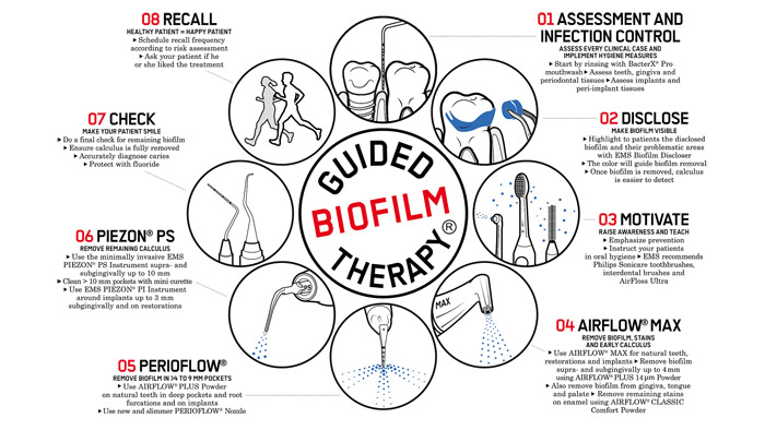 guided biofilm therapy