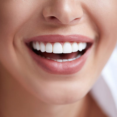 woman with beautiful teeth