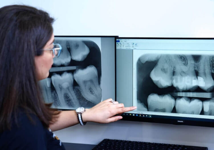 person reviewing tooth xrays