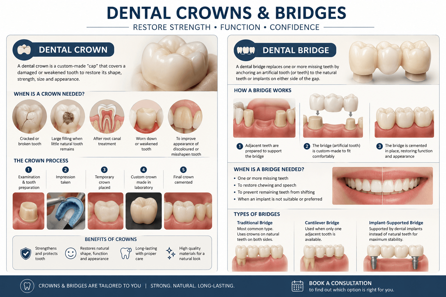 crowns-and-bridges