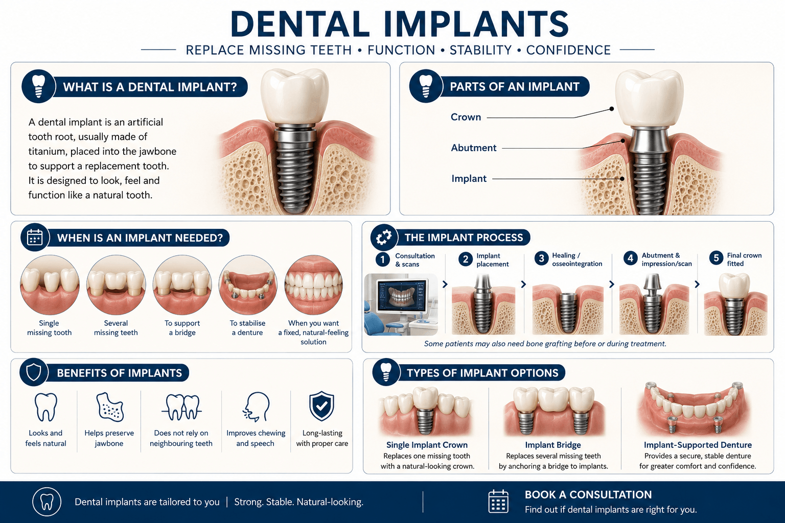implant