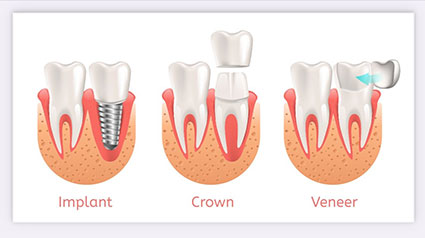 Restorative dentistry examples