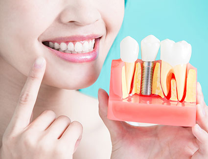 Woman holding dental implant model