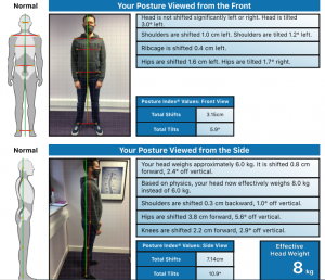 How Your Posture is Affecting Your SP