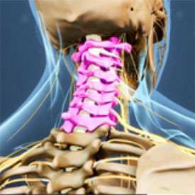 Neck pain model