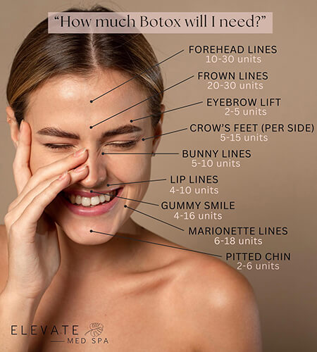 Botox-Guide