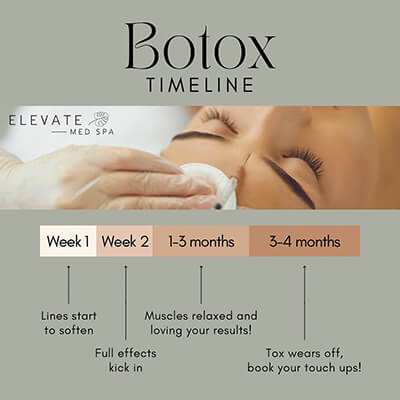 Botox-Timeline