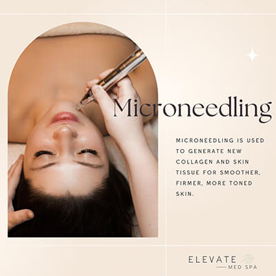 Micro-Needling