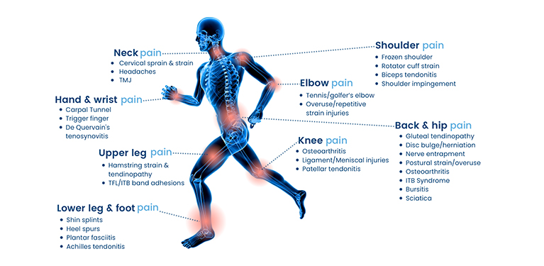 Shockwave therapy