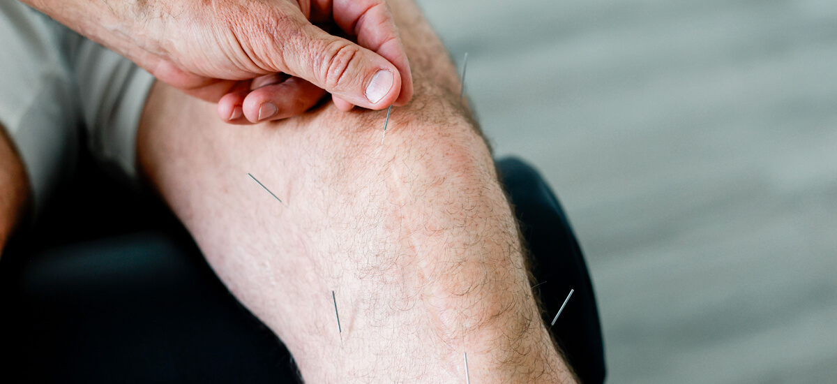 acupuncture on knee