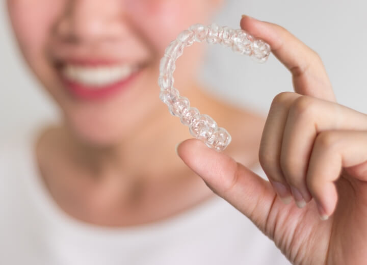 clear aligners